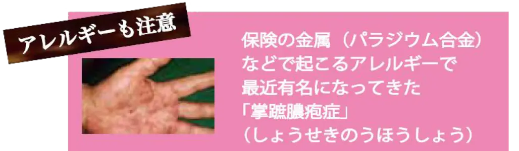 アレルギーも注意。保険の金属（パラジウム合金）などで起こるアレルギーで最近有名になってきた「掌蹠膿疱症」